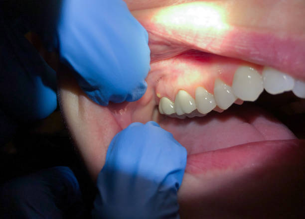 Best Emergency Root Canal Treatment in Oregon, IL