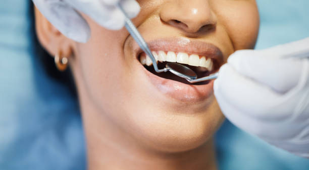 Best Emergency Tooth Extraction in Oregon, IL